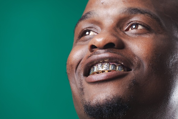 Options For Teeth Jewelry
